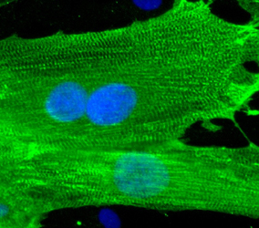 Human Cardiomyocyte Differentiation Media | Cell Applications