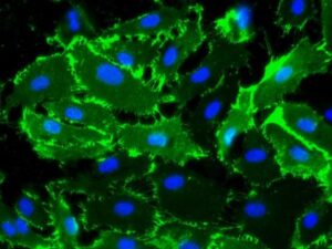 1803 HAOEC CD31 staining