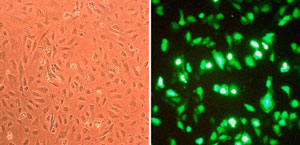 1803 HAOEC transfection
