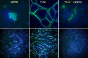 1803 HUVEC+HDF 3D angiogenesis CD31 staining