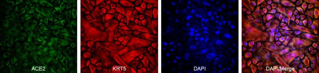 HBEpC ACE2 KRT5 staining CAI-UCSD 200504 Das v2