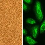 Human Placental Epithelial Cells: HPlEpC