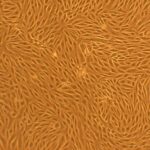 Bovine Brain Artery Endothelial Cells: BBAEC