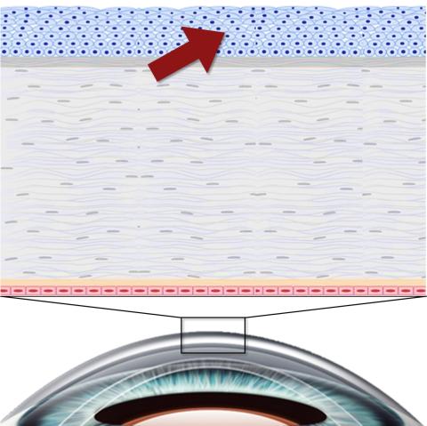 Cornea & HCEpC