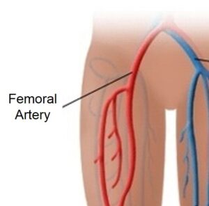 Femoral Artery
