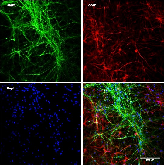 i-HNSC Differentiation Potential Hi Contrast