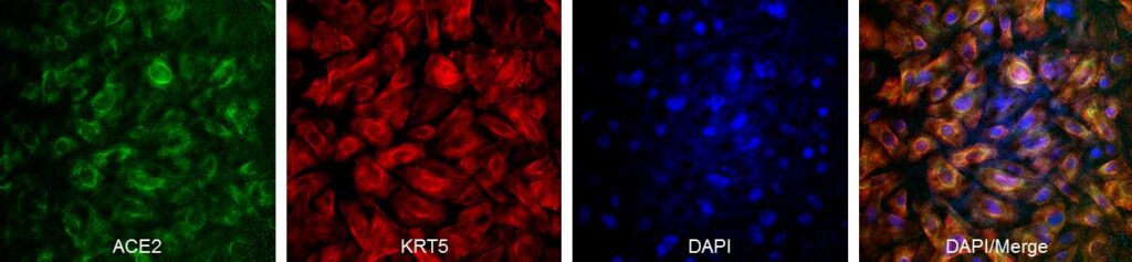 SAEpC ACE2 KRT5 staining 200504_0