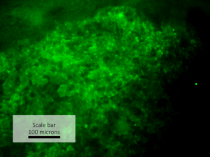 CFDA-2D: Biliary ducts are visible throughout a cluster of i-HH
