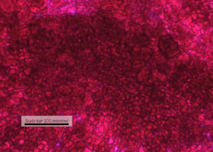 Glycogen Storage in i-HH is extremely heavy