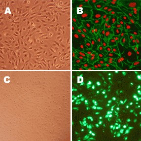 Human Aortic Endothelial Cells:  HAOEC
