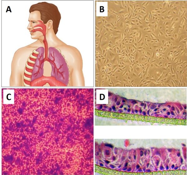 3D Airway Model