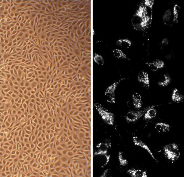 Bovine Aortic Endothelial Cells: BAOEC