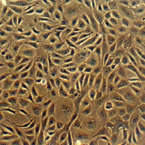 Bovine Coronary Artery Endothelial Cells: BCAEC