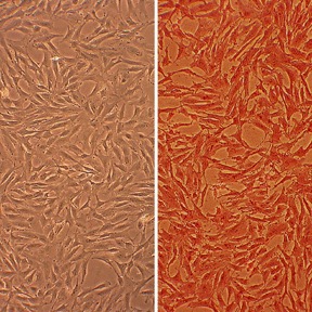Bovine Coronary Artery Smooth Muscle Cells: BCASMC