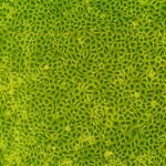 Bovine Endometrial Epithelial Cells: BEnEpC
