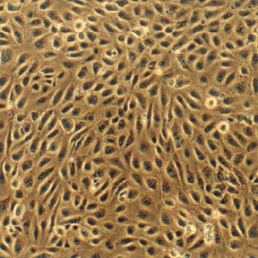 Bovine Pulmonary Artery Endothelial Cells: BPAEC