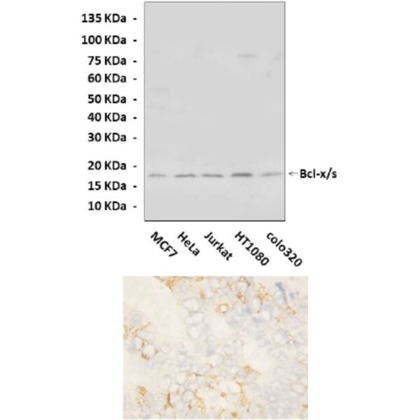 Anti-Bcl-x/s: Rabbit Polyclonal Bcl-x/s Antibody