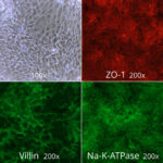 Crohn’s Disease Gastrointestinal Epithelial Cells, Naive