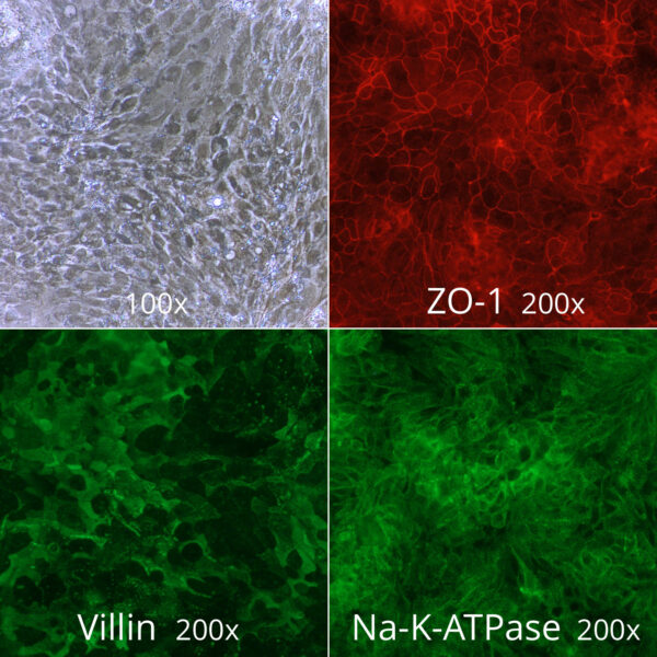 Crohn's Disease Gastrointestinal Epithelial Cells, Naive