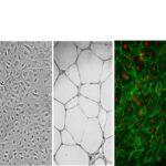 Human Dermal Microvascular Endothelial Cells: CADMEC/HMVEC