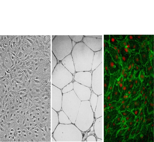 Human Dermal Microvascular Endothelial Cells: CADMEC/HMVEC