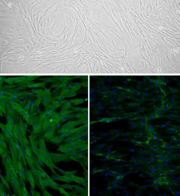 Canine Trabecular Meshwork Cells: CnTMC