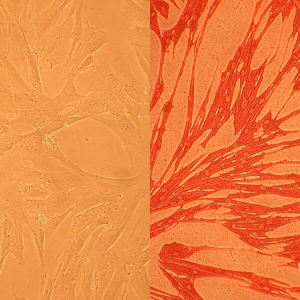 Canine Pulmonary Artery Smooth Muscle Cells: CnPASMC