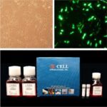 Cytofect™ Smooth Muscle Cell Transfection Kit