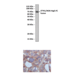 Anti-STYK1/NOK: Mouse STYK1/NOK Antibody