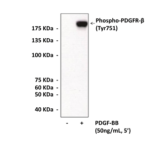 Anti-Phospho-PDGFR-β: Polyclonal Phospho-PDGF Receptorβ, Phospho-Tyr751 Antibody