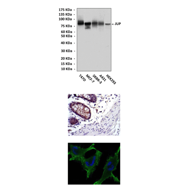 Anti-Plakoglobin/JUP: Mouse Plakoglobin/JUP Antibody