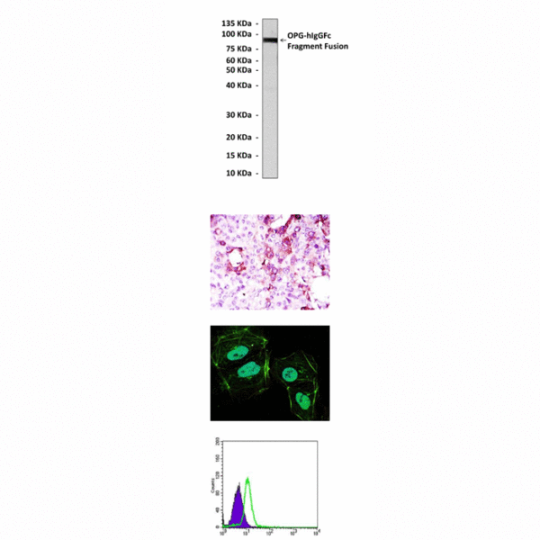 Anti-OPG/TNFRSF11B: Mouse Osteroprotegerin/TNFRSF11B Antibody