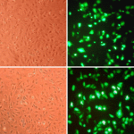 Cytofect™ Endothelial Cell Transfection Kit