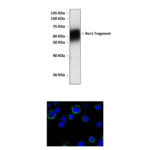 Anti-Ror1: Mouse Monoclonal Ror1 Antibody