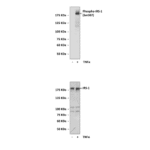 Anti-Phospho-IRS-1: Polyclonal Insulin Receptor Substrate, Phospho-Ser307 Antibody