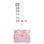 Anti-SNCG: Mouse γ-Synuclein Antibody