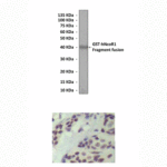 Anti-NcoR1: Mouse Nuclear Receptor Corepressor 1 Antibody