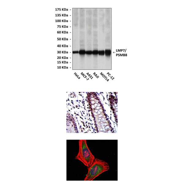 Anti-LMP7/PSMB8: Mouse LMP7/PSMB8 Antibody