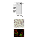 Anti-MSH2: Mouse MutS Homolog 2 Antibody