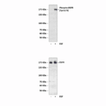 Anti-Phospho-EGFR: Polyclonal Epidermal Growth Factor Receptor, Phospho-Tyr1173 Antibody
