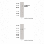 Anti-Phospho-FAK: Polyclonal Focal Adhesion Kinase, Phospho-Tyr397 Antibody