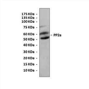 Anti-PP2A: Rabbit PP2A A subunit Antibody