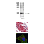 Anti-S100A10/p11: Mouse S100A10/p11 Antibody