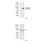 Anti-Phospho-Syk: Polyclonal Syk, Phospho-Tyr525/Tyr526 Antibody