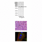 Anti-MCL-1: Mouse Myeloid Cell Leukemia-1 Antibody