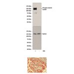 Anti-Phospho-EphA2: Rabbit EphA2, Phospho-Ser897 Antibody