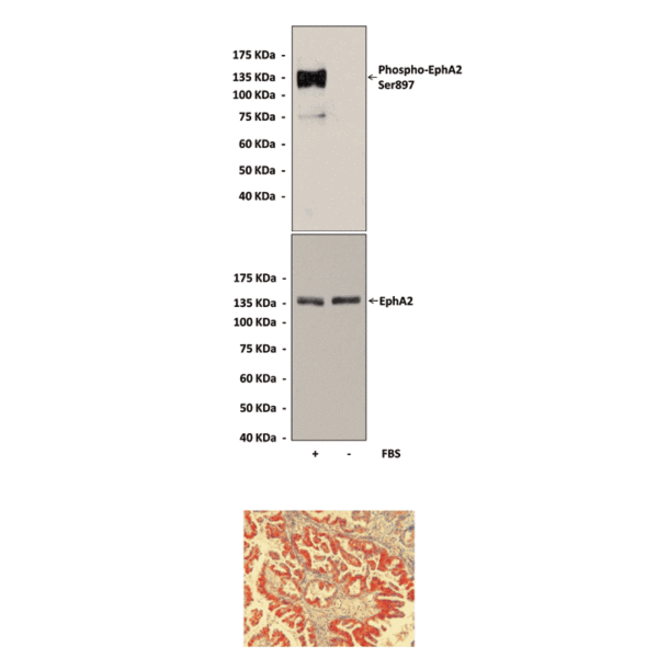 Anti-Phospho-EphA2: Rabbit EphA2, Phospho-Ser897 Antibody