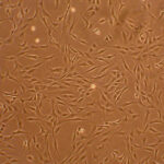 Human Chondrocytes: Osteoarthritis: HC-OA