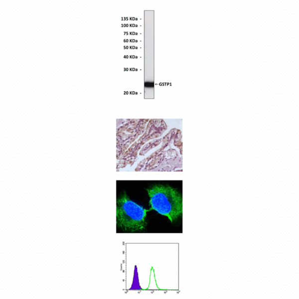Anti-GSTP1: Mouse Glutathione S-Transferase Pi 1 Antibody