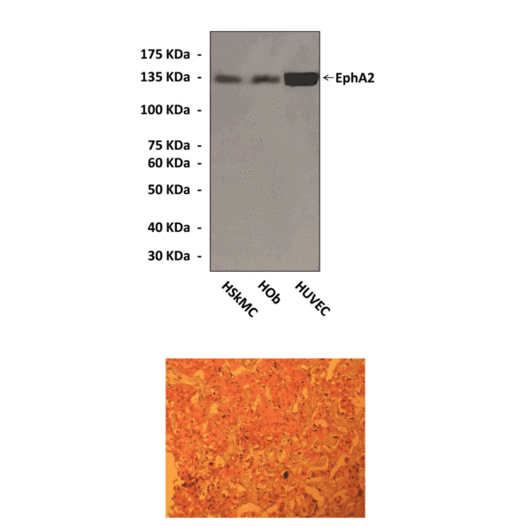 Anti-EphA2: EphA2 Mouse Monoclonal Antibody